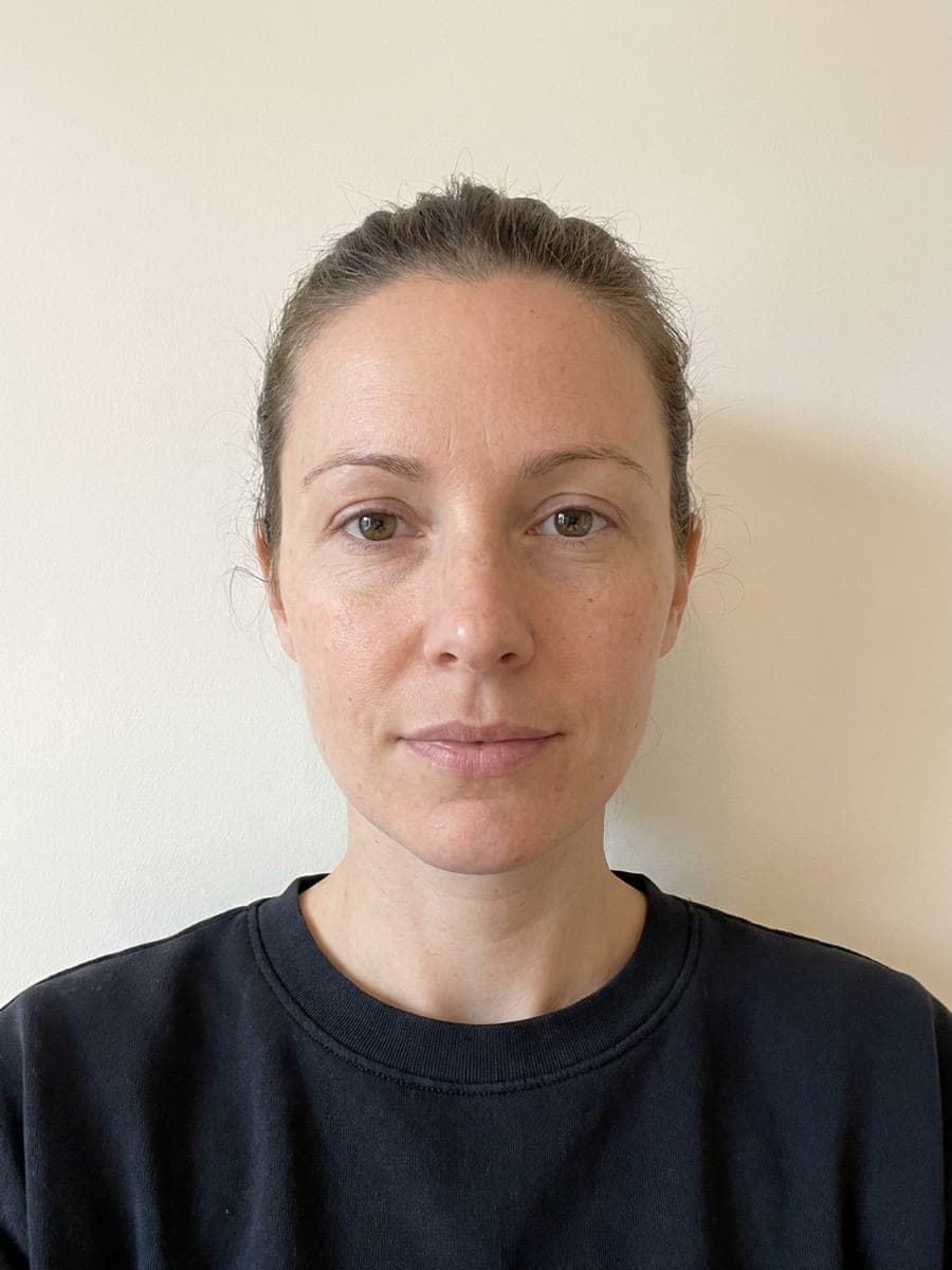 Before: a front-facing portrait of a woman with natural, fairly thin lips
